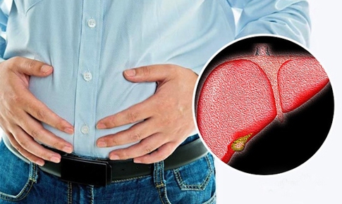 Nguyên nhân thường gặp khiến gan nhiễm mỡ ngày càng “trẻ hóa”