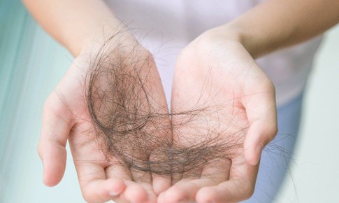 3 bí quyết hạn chế rụng tóc ở tuổi mãn kinh