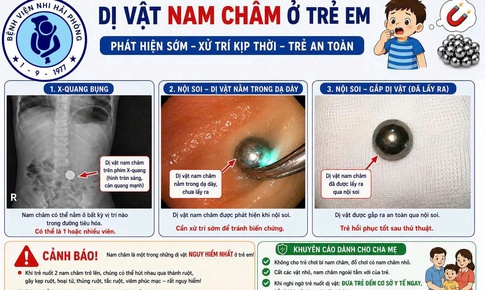 Bé gái 38 tháng tuổi nuốt phải nam châm và lời cảnh báo từ bác sĩ