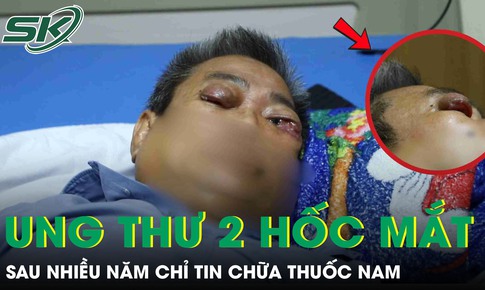 Người đàn ông 61 tuổi ung thư 2 hốc mắt sau nhiều năm chỉ tin chữa thuốc nam