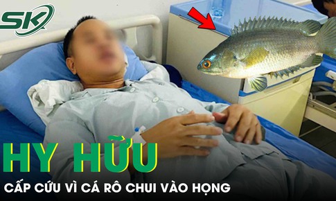 Cá rô chui vào họng, người đàn ông 39 tuổi cấp cứu trong đau đớn