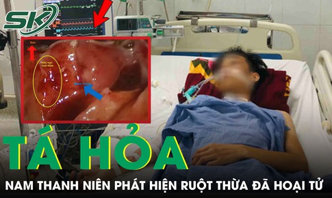 Tưởng bị rối loạn tiêu hóa, nam thanh niên 23 tuổi tá hỏa phát hiện ruột thừa đã hoại tử