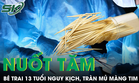 Bé 13 tuổi nguy kịch vì tràn mủ màng tim, bác sĩ sốc khi phát hiện chiếc tăm tre cắm ở tim