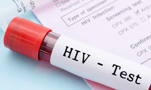 Sau quan hệ tình dục không an toàn bao lâu thì nên xét nghiệm HIV?