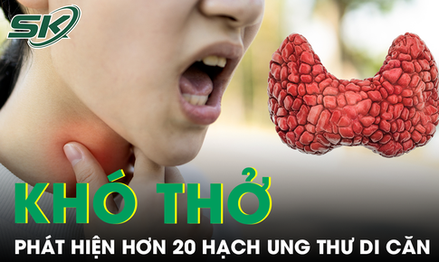 Khó thở mất tiếng, người phụ nữ phát hiện hơn 20 hạch ung thư di căn