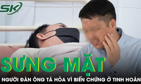 Tá hỏa vì tinh hoàn gặp biến chứng do chủ quan với dấu hiệu sưng mặt