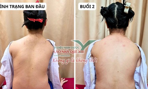 Tìm hiểu nguyên lý 'Khai thông cột sống' của Lão Nhà Quê