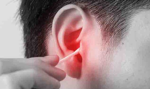Côn trùng chui vào tai, xử trí sai có thể gây tổn thương thính lực
