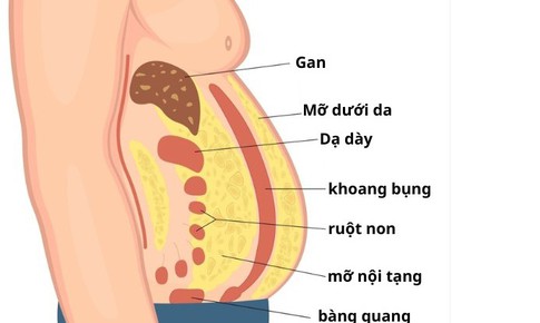 Mỡ nội tạng nguy hiểm hơn mỡ dưới da như thế nào?