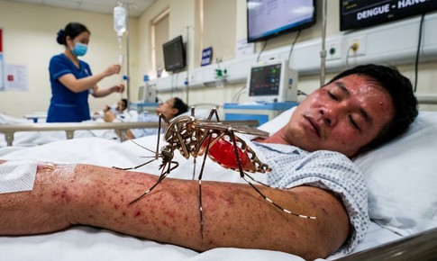 Phân biệt sốt xuất huyết và cúm mùa