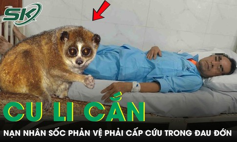 Bị cu li cắn, người đàn ông sốc phản vệ nguy kịch phải cấp cứu trong đau đớn