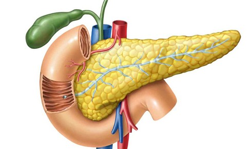 Tăng mỡ máu có thể gây viêm tụy cấp nguy hiểm đến tính mạng