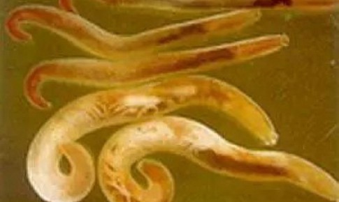Phát hiện 2 lượt dương tính với giun đầu gai ở Khánh Hòa, bác sĩ cảnh báo nguy cơ từ món ăn khoái khẩu