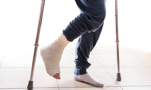 Lưu ý khi phục hồi chức năng sau gãy xương