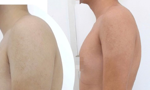 Cổ rụt, lưng gù vì ngồi học vẹo vọ, bò ra bàn
