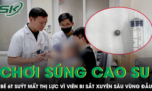 Chơi súng cao su với anh, bé 6 tuổi suýt mất thị lực vì viên bi sắt xuyên sâu vùng đầu