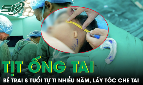 Tai nhỏ bẩm sinh kèm tịt ống tai khiến bé trai 8 tuổi tự ti nhiều năm