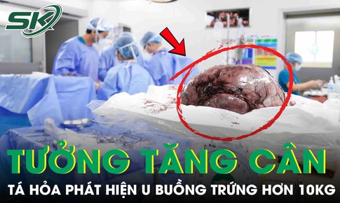 Tưởng tăng cân, nữ sinh 17 tuổi phát hiện khối u buồng trứng nặng hơn 10kg