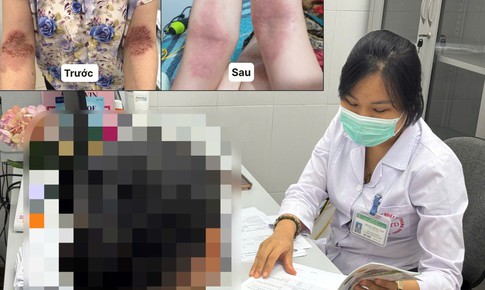 Người phụ nữ thoát cảnh 6 năm quấn khăn quanh người nhờ phác đồ đặc biệt
