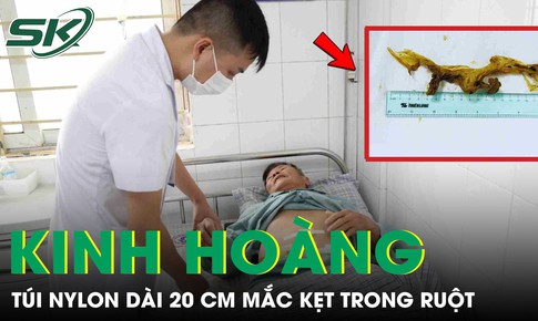 Kinh hoàng: Túi nilon dài 20 cm mắc kẹt trong ruột bệnh nhân