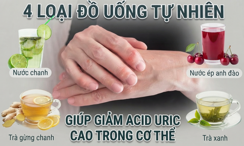 4 loại đồ uống tự nhiên giúp giảm acid uric cao trong cơ thể