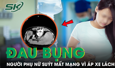 Đau bụng, sốt kéo dài tưởng bệnh thông thường, người phụ nữ suýt mất mạng vì áp xe lách