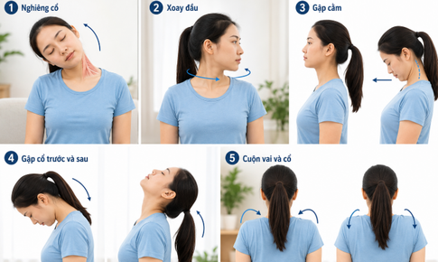 5 bài tập giúp cải thiện độ linh hoạt cột sống cổ