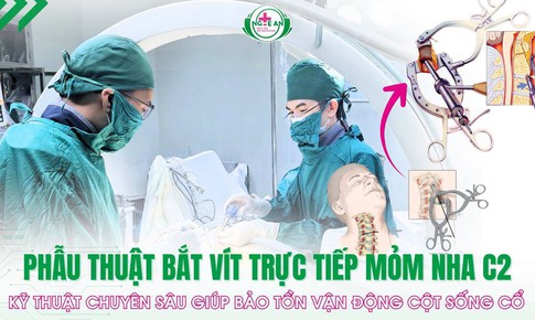 Bệnh viện HNĐK Nghệ An làm chủ kỹ thuật bắt vít trực tiếp mỏm nha C2, bảo tồn vận động cột sống cổ