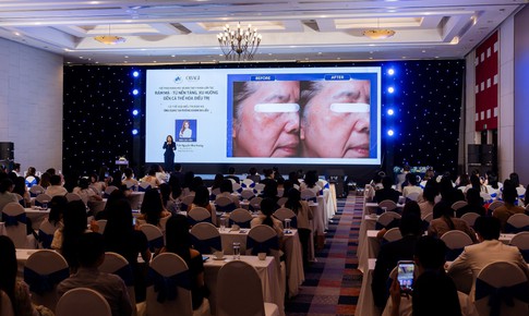 Rám má không còn là bệnh lý thẩm mỹ đơn thuần