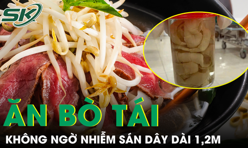 Thói quen ăn bò tái khiến người đàn ông 66 tuổi nhiễm sán dây dài 1,2m 