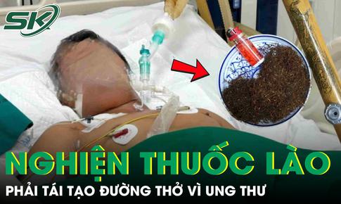 Người đàn ông phải tái tạo đường thở vì ung thư sau 30 năm nghiện thuốc lào