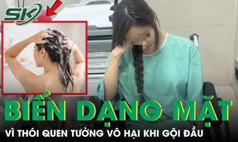 Cô gái 22 tuổi biến dạng mặt vì sai lầm khi gội đầu vào mùa hè
