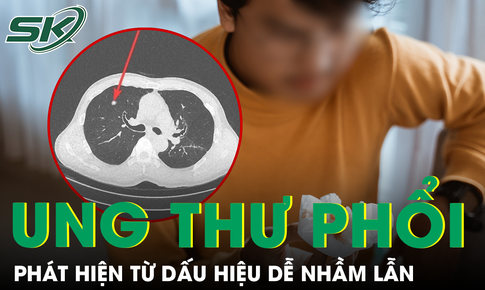 Nam kỹ sư phát hiện mắc ung thư phổi di căn ở tuổi 34 từ dấu hiệu nhiều người dễ chủ quan