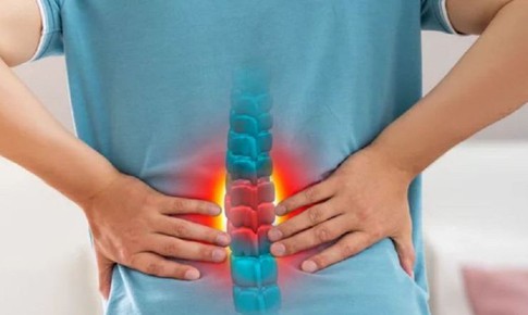 Đau lưng âm ỉ là dấu hiệu cảnh báo những bệnh gì?