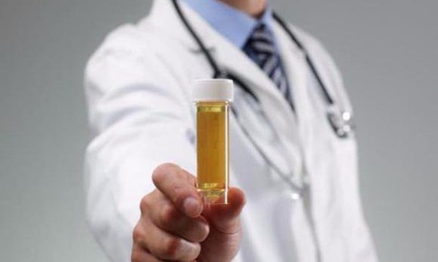 Nước tiểu đục do nguyên nhân gì và cách xử trí