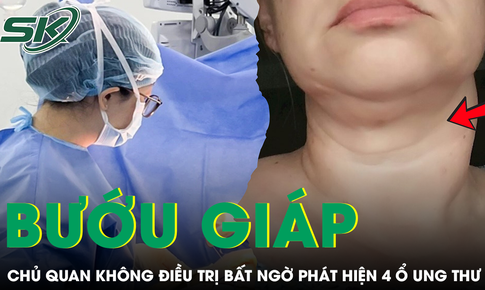 Bướu giáp 10 năm không điều trị, người phụ nữ phát hiện 4 ổ ung thư tuyến giáp