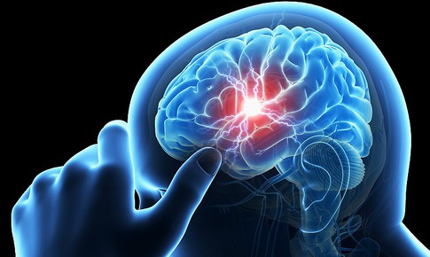 5 thói quen xấu âm thầm tàn phá sức khỏe não bộ