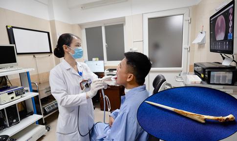 Cố nuốt miếng cơm to để chữa hóc xương, người đàn ông thủng thực quản