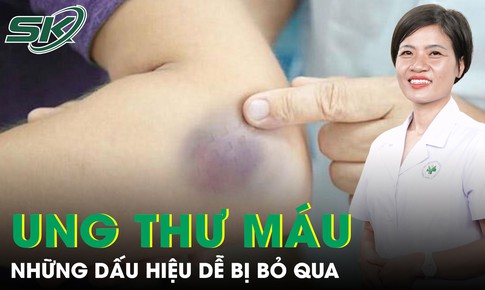 Những dấu hiệu ung thư máu dễ bị bỏ qua