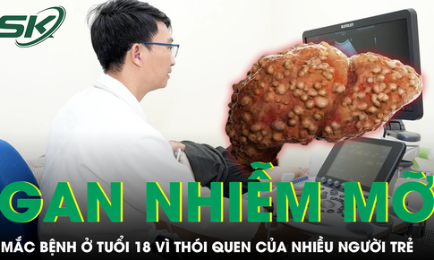 Nam sinh 18 tuổi mắc gan nhiễm mỡ độ ba vì lối sống nhiều người trẻ đang mắc
