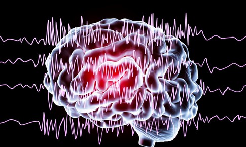 Động kinh ở trẻ em có chữa khỏi được không?