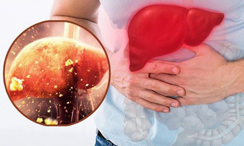 7 dấu hiệu tổn thương gan 