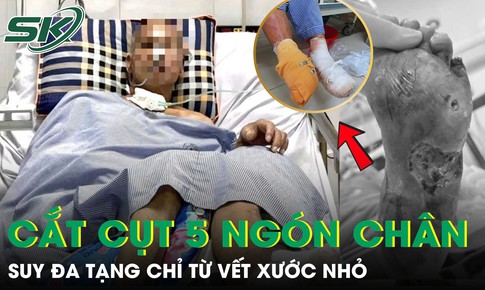 Người đàn ông suy đa tạng, phải cắt cụt 5 ngón chân chỉ từ vết xước nhỏ