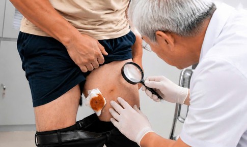 Suýt mang họa vì vô tình uống nước suối khi bơi