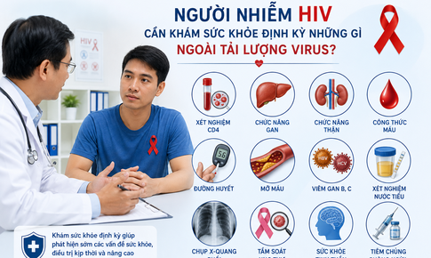Người nhiễm HIV cần khám sức khỏe định kỳ những gì ngoài tải lượng virus?
