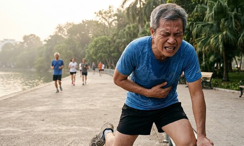 Chạy bộ khi mỡ máu cao: 5 sai lầm nam giới sau 50 tuổi cần tránh
