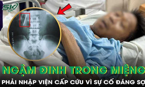 Ngậm đinh trong miệng, người đàn ông 50 tuổi phải nhập viện cấp cứu
