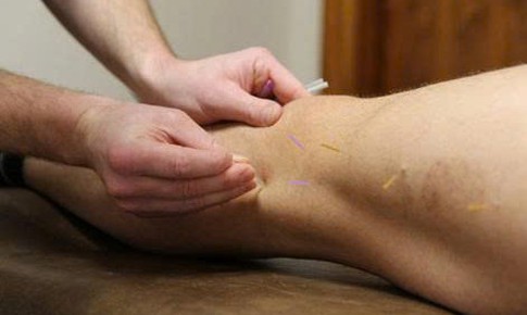 Ngồi lâu, ít vận động, bệnh suy giãn tĩnh mạch ngày càng phổ biến