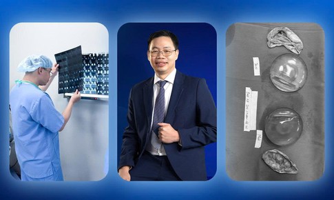 Đừng chủ quan với những dấu hiệu bao xơ khi nâng ngực