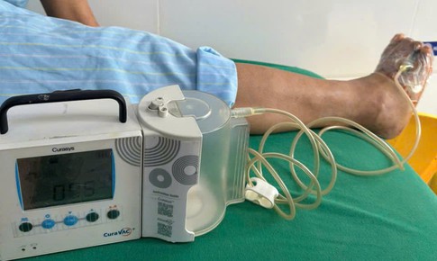 Bảo tồn bàn chân cho bệnh nhân người Lào bị nhiễm trùng do đái tháo đường